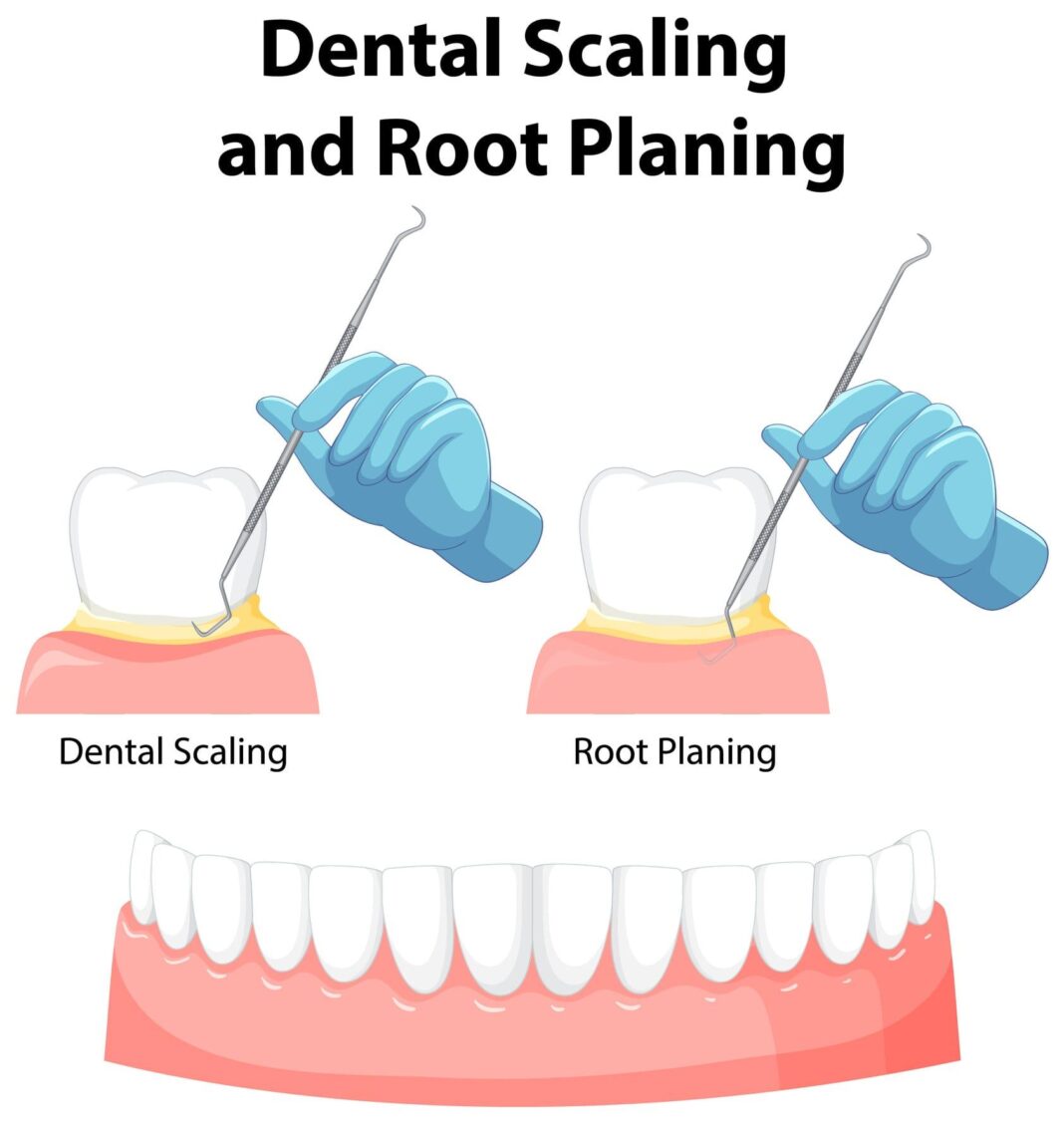 The one thing you must fix before scaling