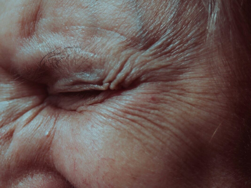 how to eliminate wrinkles under the eyes​