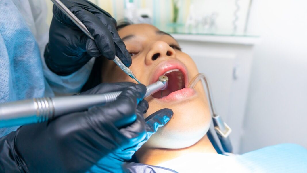 how long to keep gauze in after tooth extraction​
